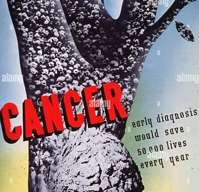 cancer - Alamy 1